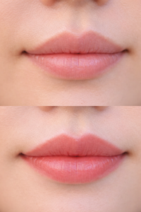 Lip Blush Tattoo in Osaka